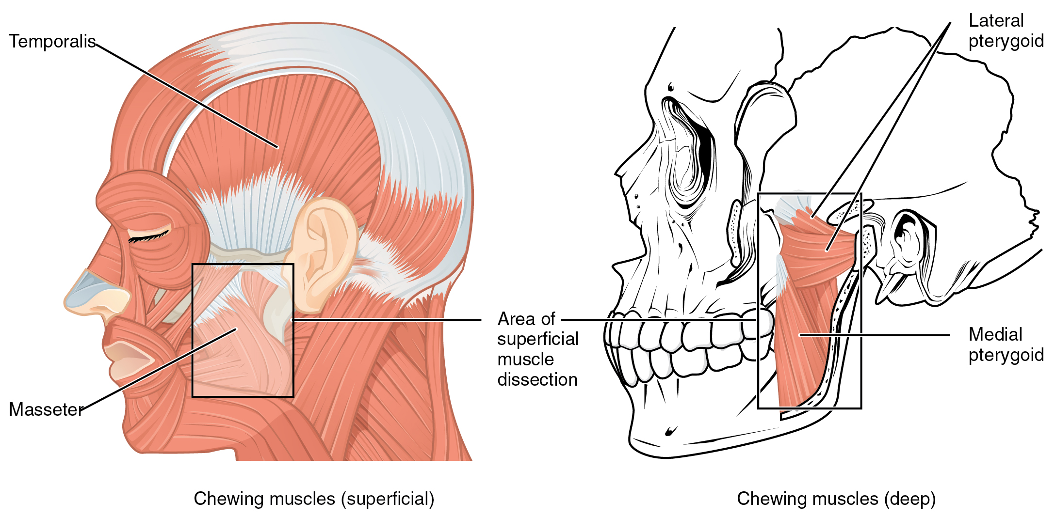 TMJ dysfunction